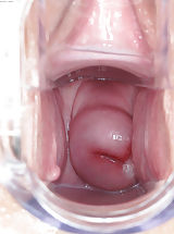Nasse Fotze, Large Labia and Vagina Picture from ITC