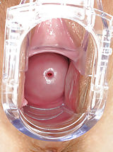 Large Labia and Vagina Picture from ITC